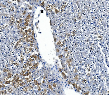 IRAK2 Rabbit Polyclonal Antibody