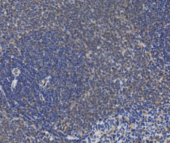 IRAK2 Rabbit Polyclonal Antibody