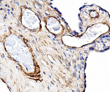 CD31/Pecam1 Rabbit Polyclonal Antibody