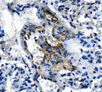 CD31/Pecam1 Rabbit Polyclonal Antibody