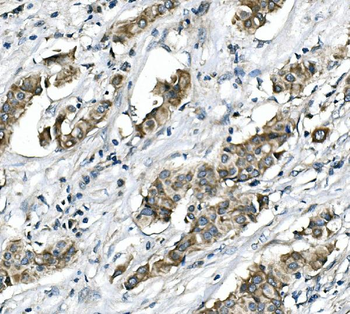 RICTOR Rabbit Polyclonal Antibody