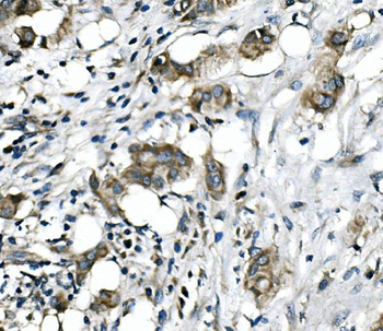 RICTOR Rabbit Polyclonal Antibody