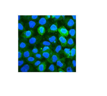 CD59 Mouse Monoclonal Antibody
