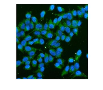 CD59 Mouse Monoclonal Antibody