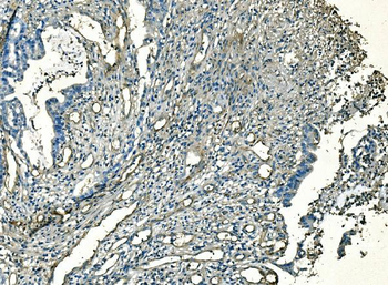 CD59 Mouse Monoclonal Antibody