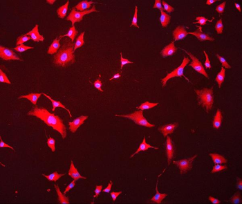 Hsc70 Mouse Monoclonal Antibody
