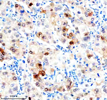 Hsc70 Mouse Monoclonal Antibody