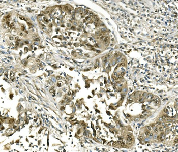 Hsc70 Mouse Monoclonal Antibody