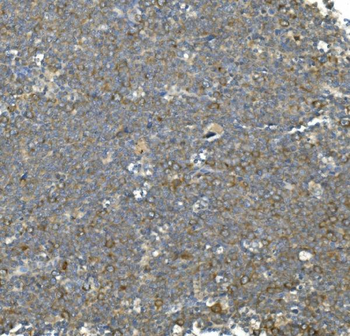 Hsc70 Mouse Monoclonal Antibody