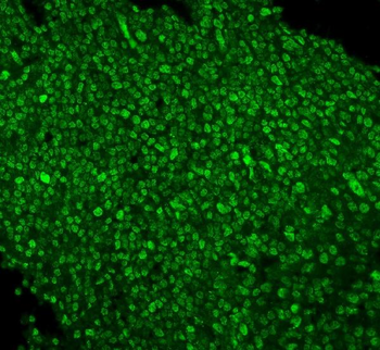 PTBP1 Mouse Monoclonal Antibody