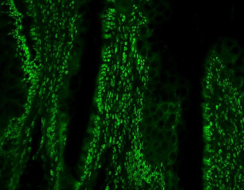 PTBP1 Mouse Monoclonal Antibody