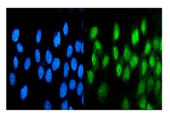 ATF1 Mouse Monoclonal Antibody