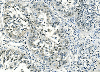 ATF1 Mouse Monoclonal Antibody