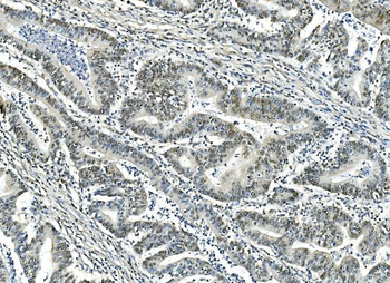 ATF1 Mouse Monoclonal Antibody