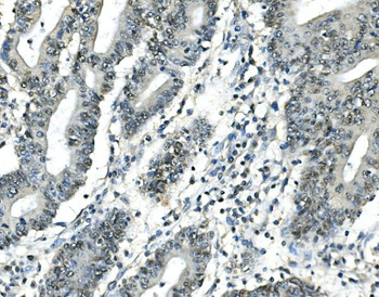 ATF1 Mouse Monoclonal Antibody