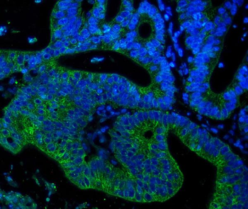 Cytokeratin 18 KRT18 Mouse Monoclonal Antibody