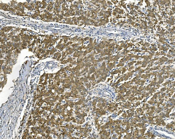AKR7A2 Rabbit Polyclonal Antibody