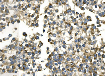 AKR7A2 Rabbit Polyclonal Antibody