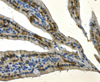AKR7A2 Rabbit Polyclonal Antibody