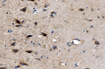 AKR7A2 Rabbit Polyclonal Antibody