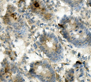 CD13/ANPEP Rabbit Polyclonal Antibody