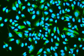 ASAH1 Rabbit Polyclonal Antibody