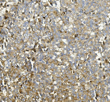 ASAH1 Rabbit Polyclonal Antibody