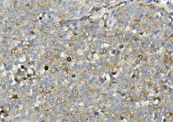 ASAH1 Rabbit Polyclonal Antibody