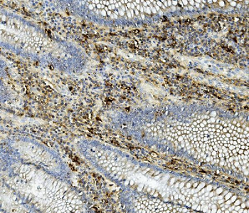 ASAH1 Rabbit Polyclonal Antibody