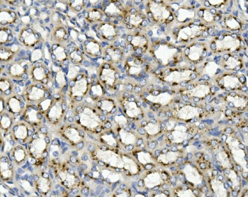 ASAH1 Rabbit Polyclonal Antibody