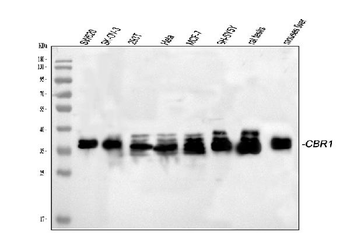 CBR1 Rabbit Polyclonal Antibody