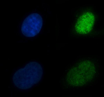 CBR1 Rabbit Polyclonal Antibody