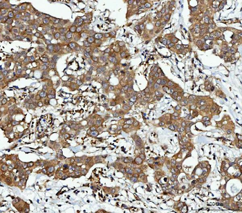 CBR1 Rabbit Polyclonal Antibody