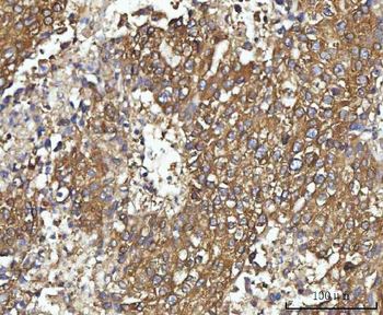 CBR1 Rabbit Polyclonal Antibody