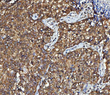 CBR1 Rabbit Polyclonal Antibody