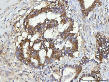 CBR1 Rabbit Polyclonal Antibody