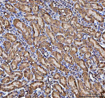 CBR1 Rabbit Polyclonal Antibody