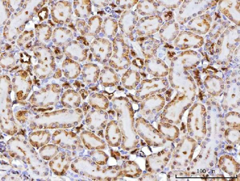 CBR1 Rabbit Polyclonal Antibody
