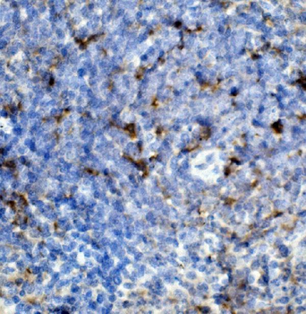 CCR2 Rabbit Polyclonal Antibody