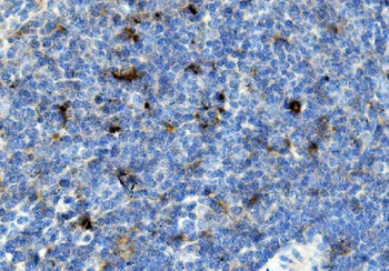 CCR2 Rabbit Polyclonal Antibody