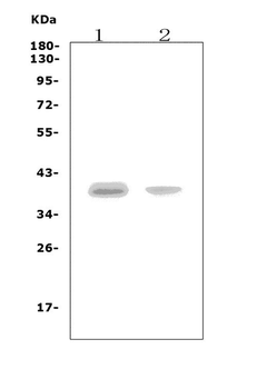 CCR5 Rabbit Polyclonal Antibody