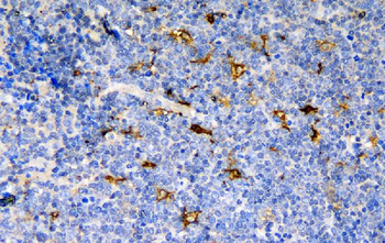 CCR6 Rabbit Polyclonal Antibody
