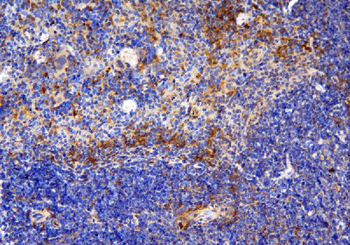 CCR6 Rabbit Polyclonal Antibody