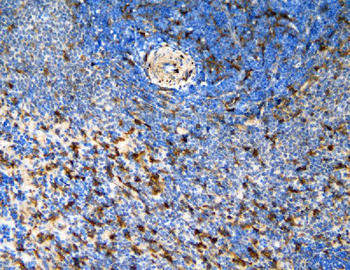 CCR6 Rabbit Polyclonal Antibody