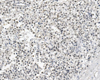 DAZL Rabbit Polyclonal Antibody