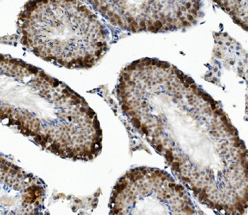DAZL Rabbit Polyclonal Antibody