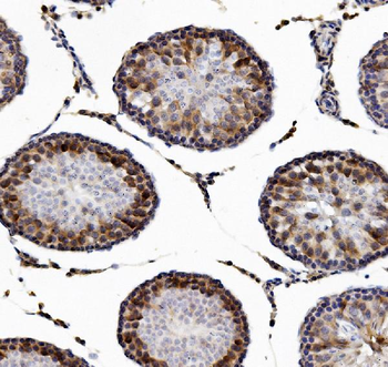 DAZL Rabbit Polyclonal Antibody