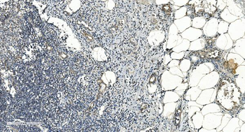FLCN Rabbit Polyclonal Antibody