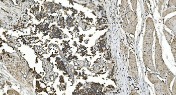 FLCN Rabbit Polyclonal Antibody