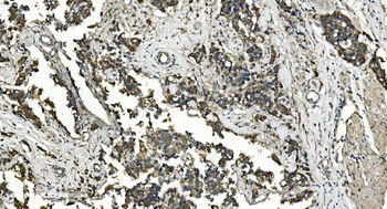 FLCN Rabbit Polyclonal Antibody
